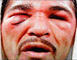 Qué tenía el vendaje de Antonio Margarito? La historia del yeso, y contra  quién y en qué pelea de box fue