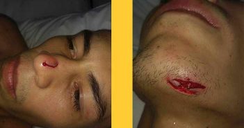 El “Jaguar” Gutiérrez sufre un accidente y cancela su pelea con Frampton