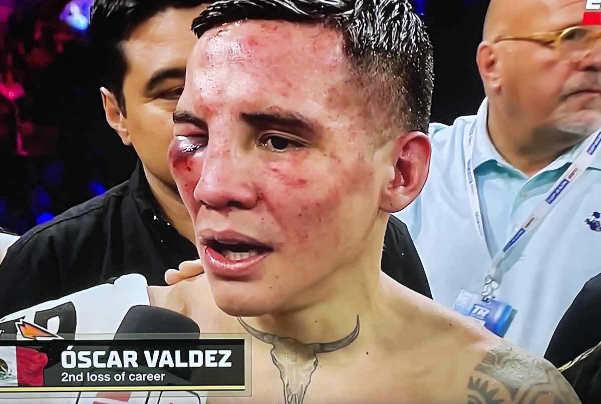 Óscar Valdez